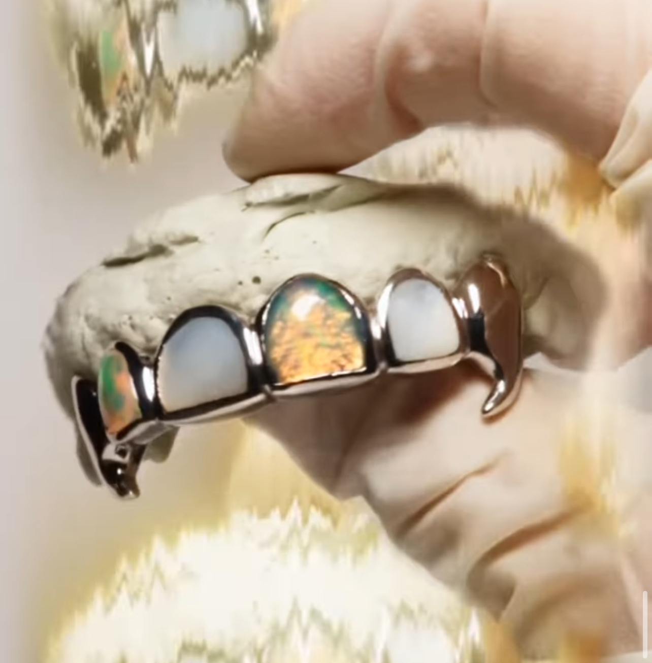Custom Gold Teeth